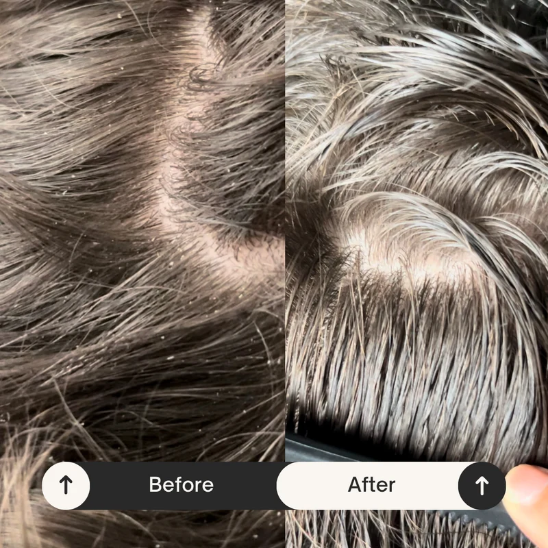 SARI CURLS | Scalp Brush