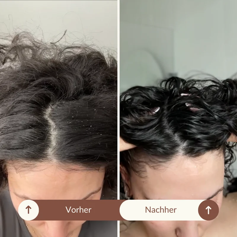 SARI CURLS | Scalp Brush