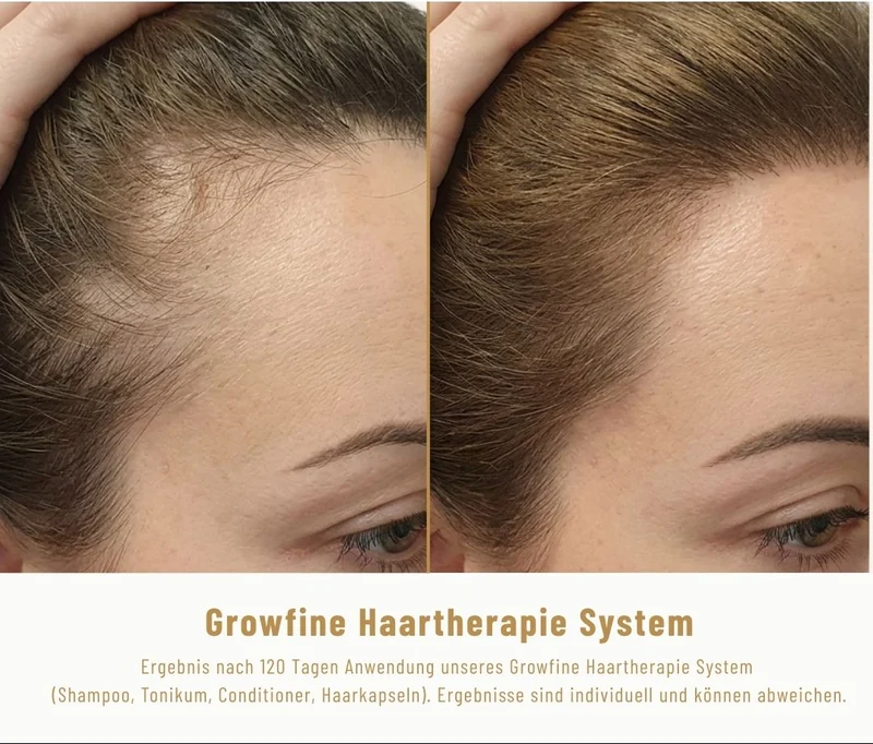 Growfine Haartherapie© Fokus-Set (Innen & Außen)