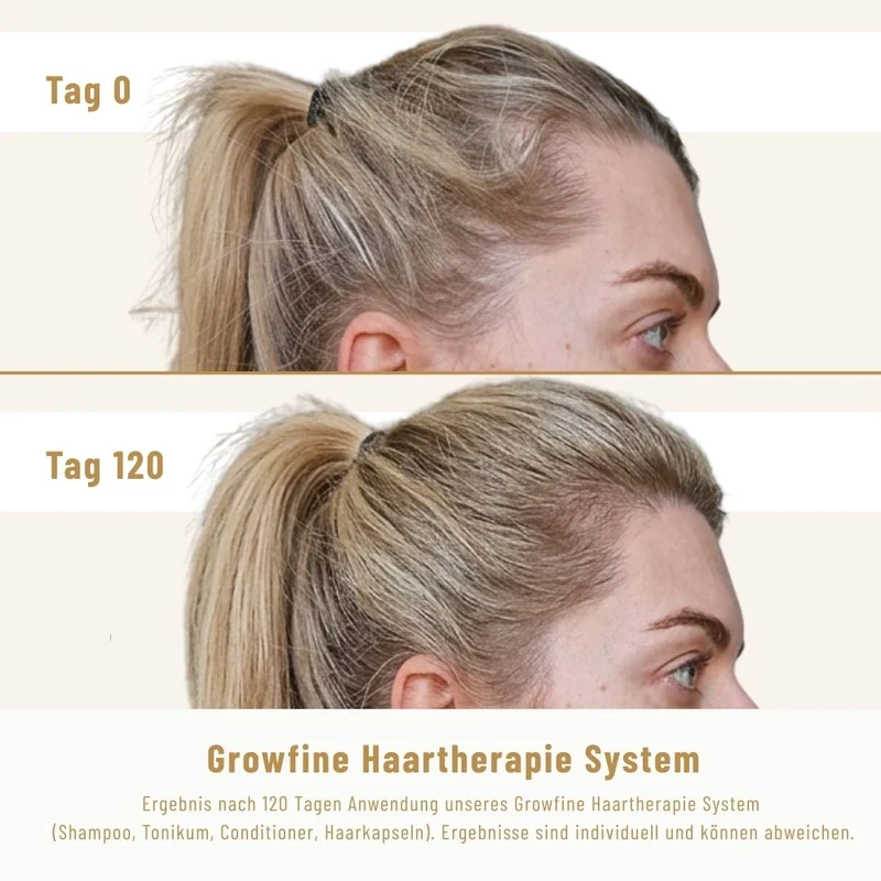 Growfine Haartherapie© Premium-Set (Innen & Außen)
