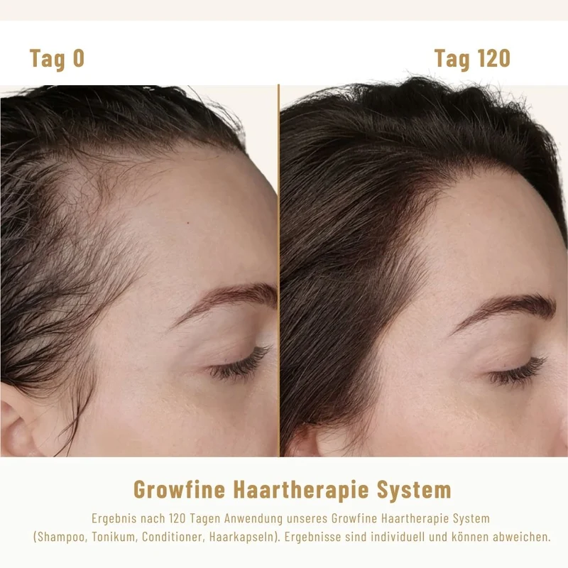 Growfine Haartherapie© Fokus-Set (Innen & Außen)