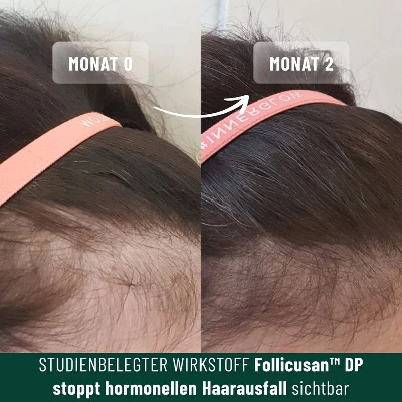 Vorteilsset: 3x Shampoo für feines Haar & Haarausfall