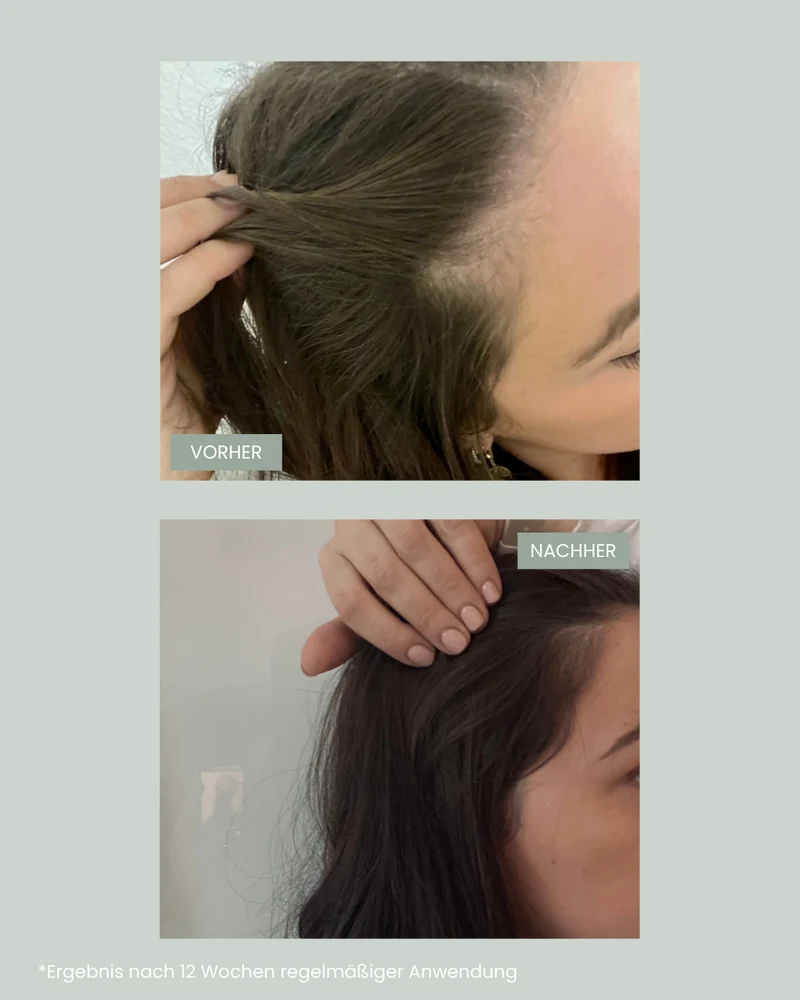Hair Growth Power Trio