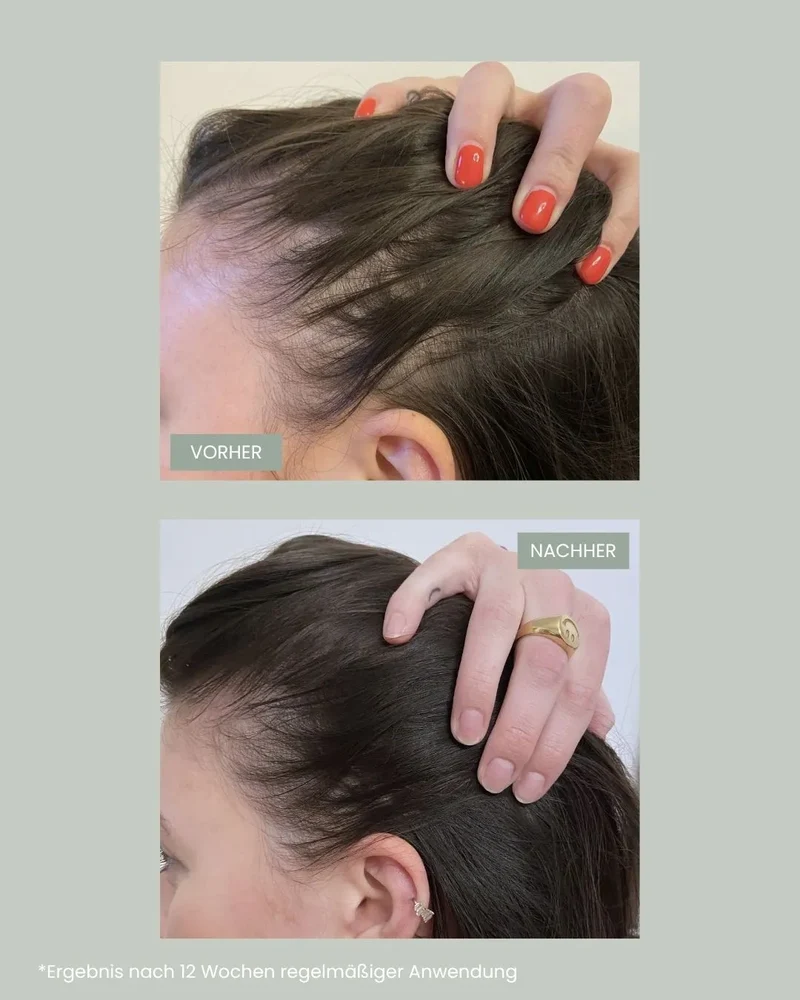 Hair Growth Power Trio