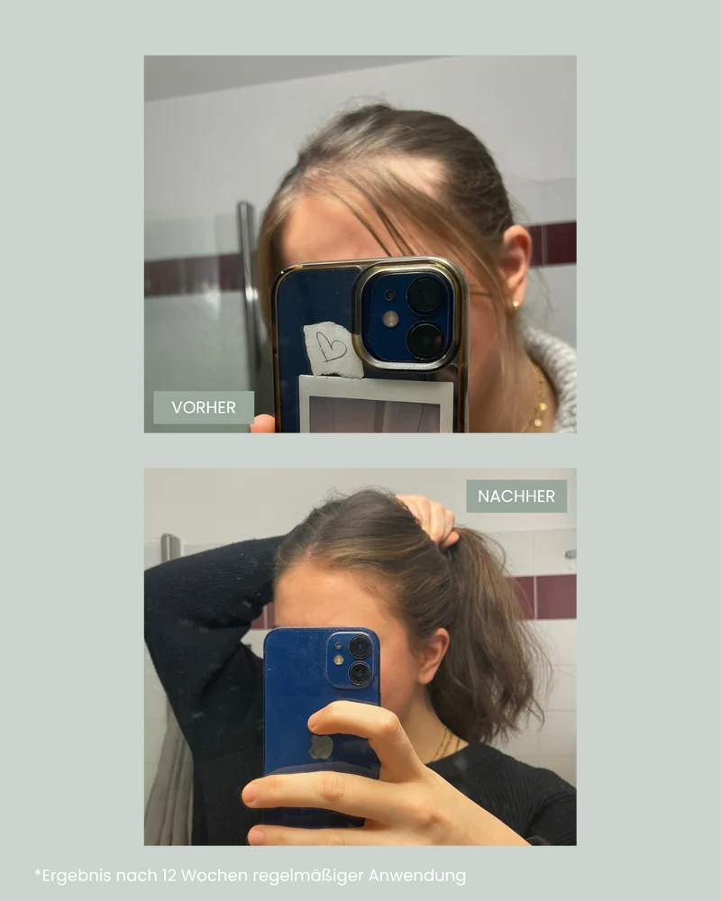 Ultimate Hair Growth Set