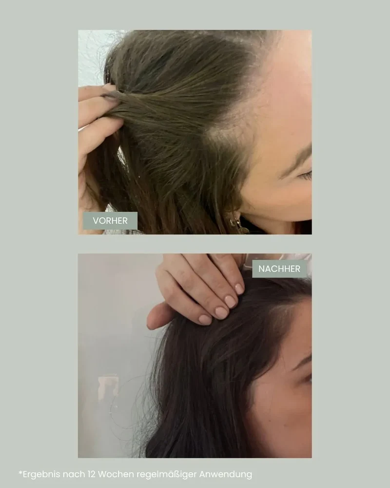 hair growth - Supplement