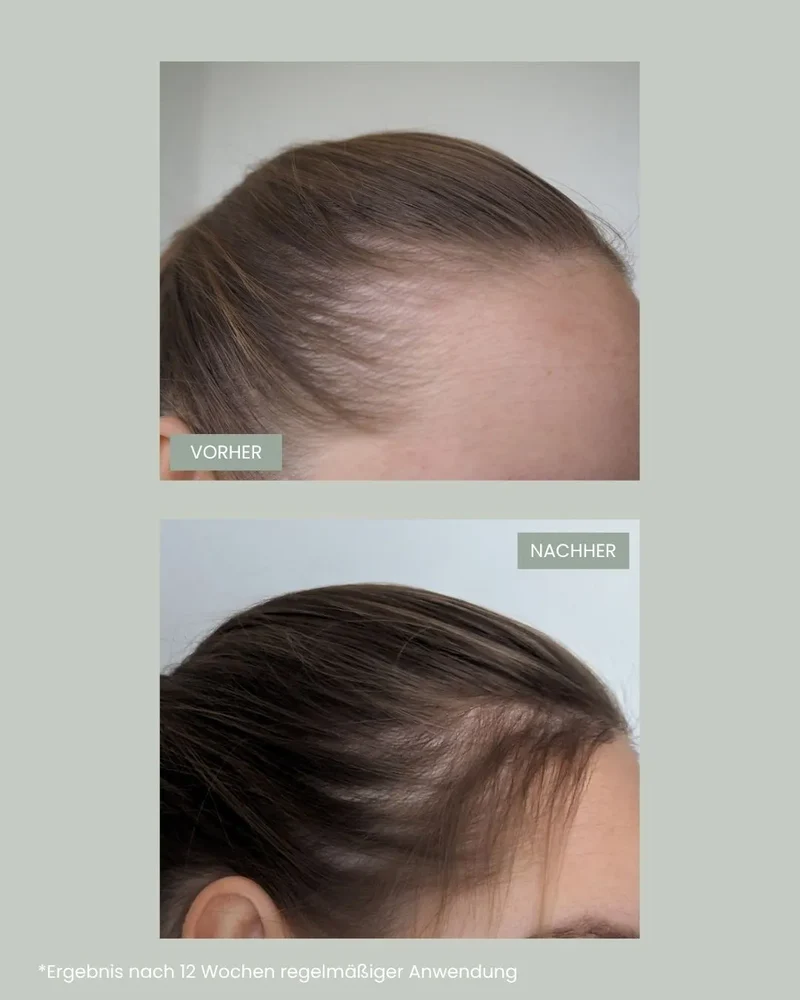 hair growth - Supplement