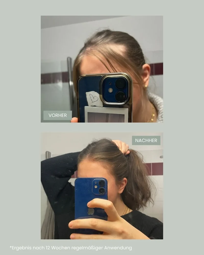 hair growth - Supplement