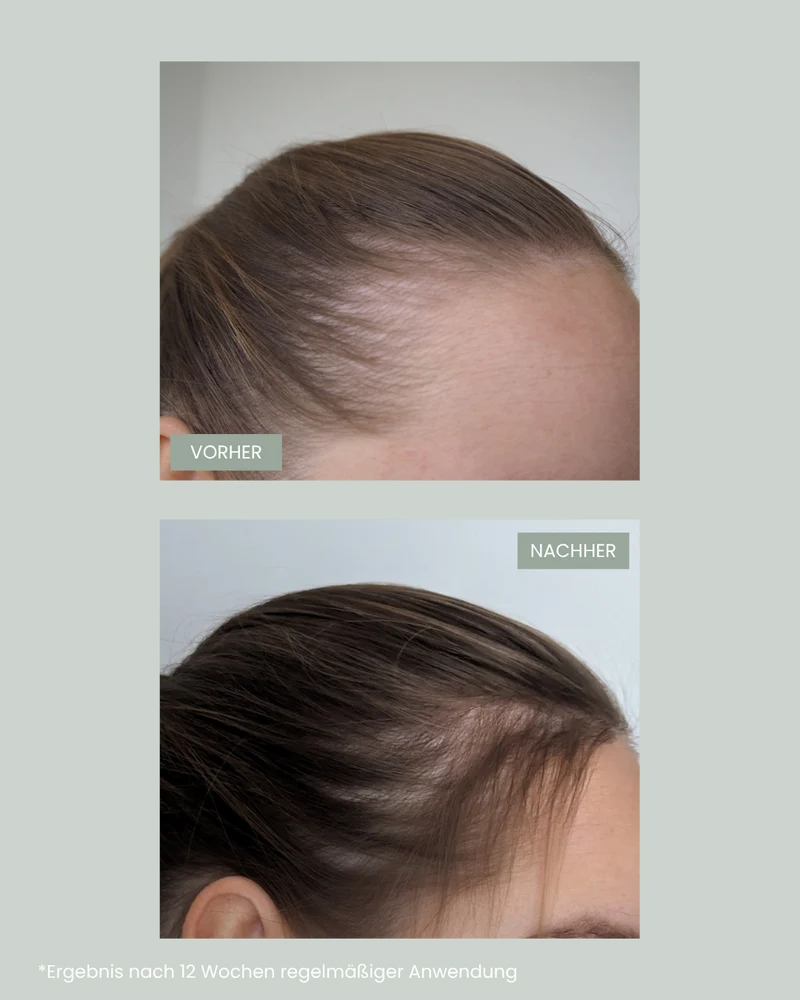Pflegeset für fülliges Haar