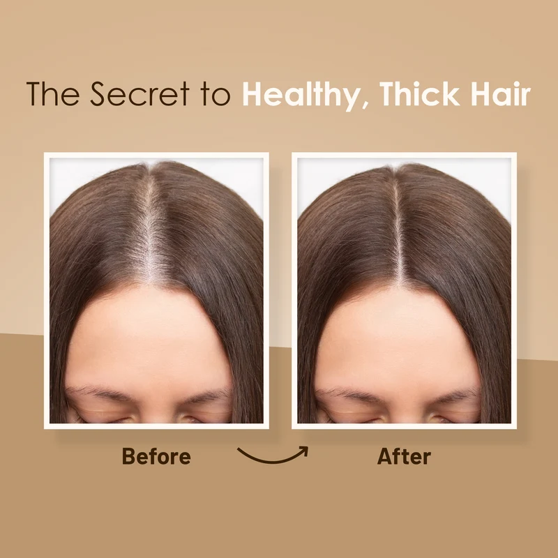Set aus Shampoo und Spülung zur Haarverdichtung – Herbishh