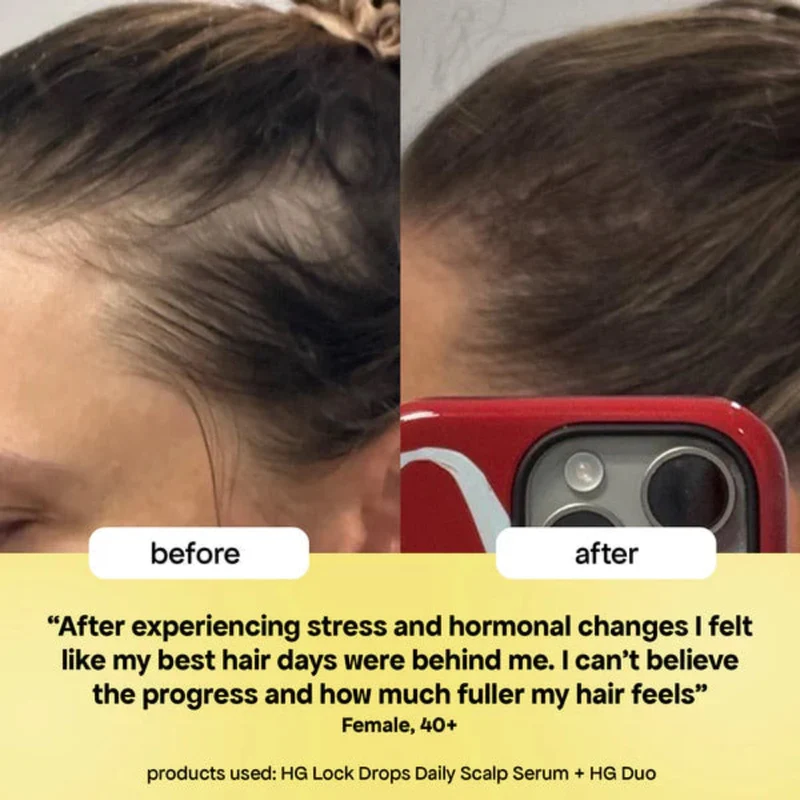 Shed Happens Hair Thinning Trio