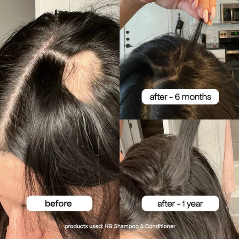 Shed Happens Hair Thinning Trio