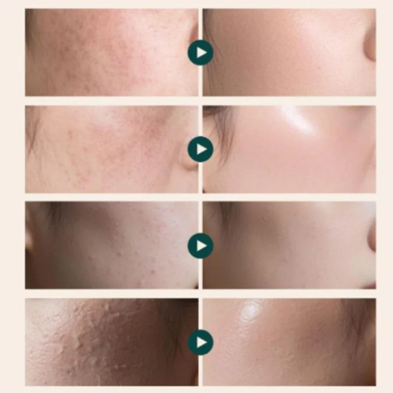 Revitalisierende Creme. Spendet intensive Feuchtigkeit und mildert Pigmentflecken.