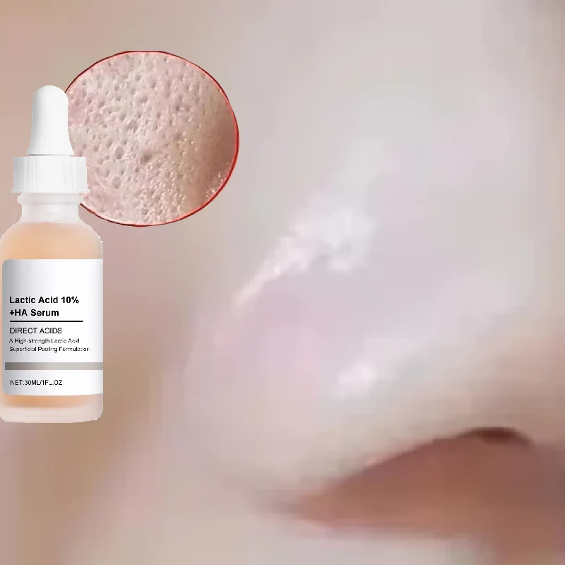 Gesichtsporenverkleinerung mit Milchsäure