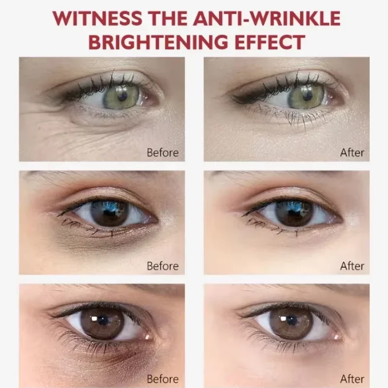 Retinol-Augencreme, Kollagen-Multibalsam