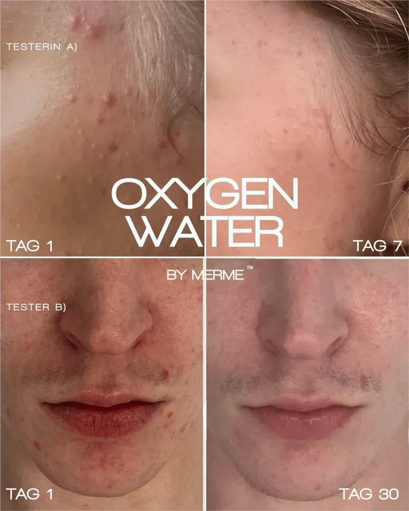 Oxygen Water