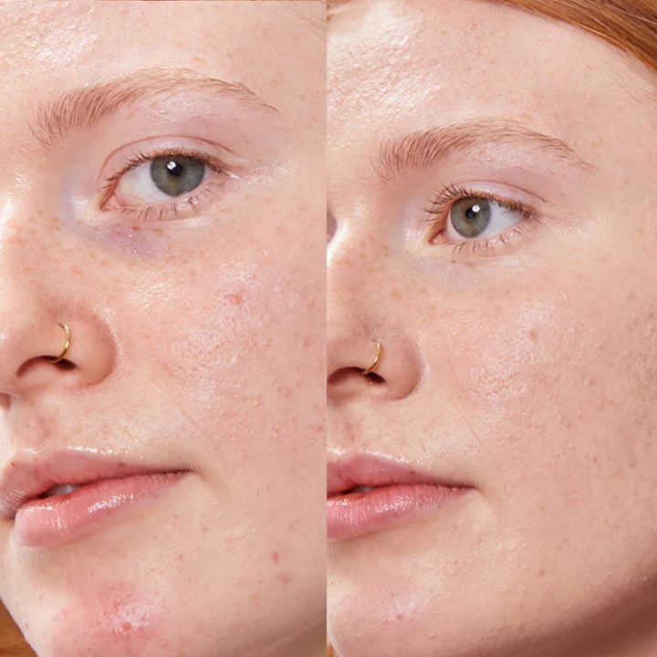 Concealer Balm 5 g
