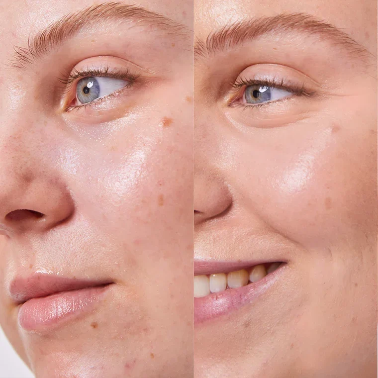 Concealer Balm 5 g