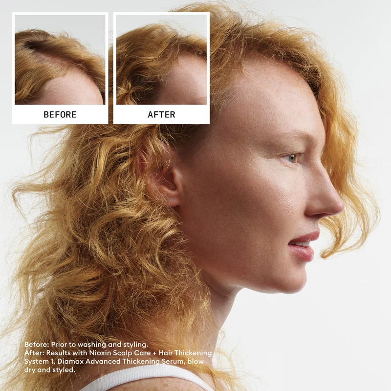 Scalp + Hair Thickening System 1 Full Size Trio