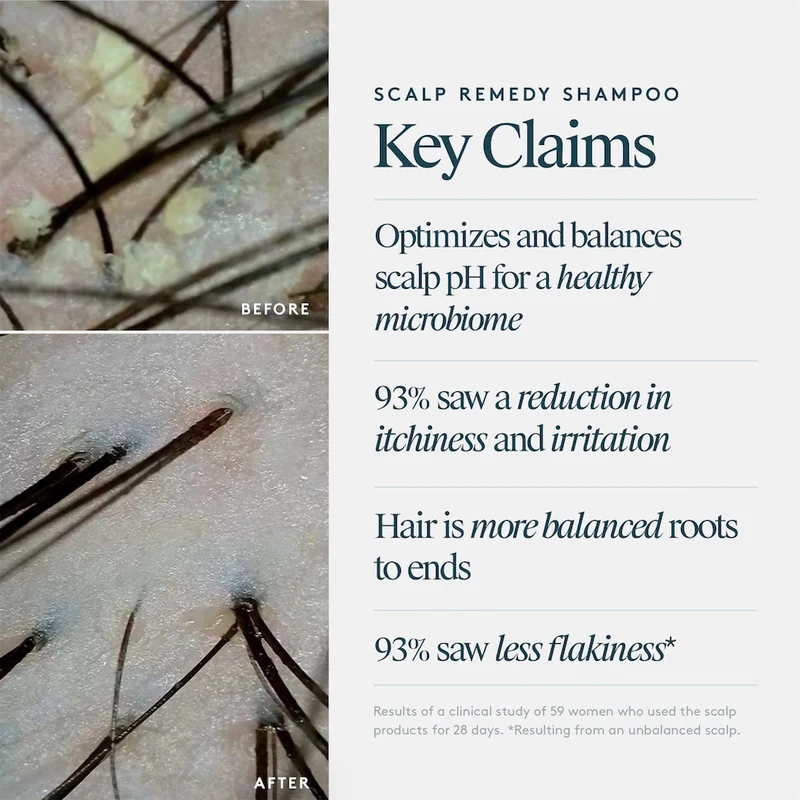 Scalp Remedy Shampoo 240ml