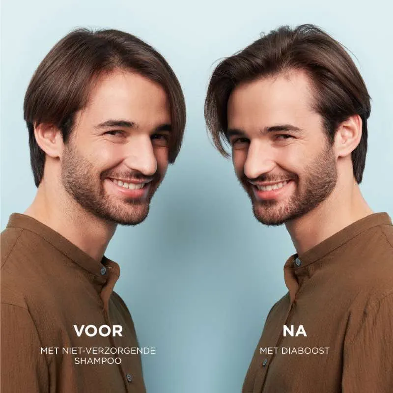 Nioxin Professional System 2 Kopfhaut-Revitalisierer
