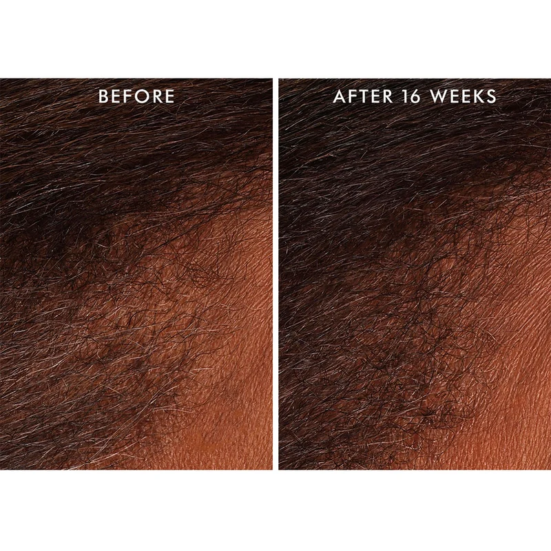 Scalp Tonic 100ml