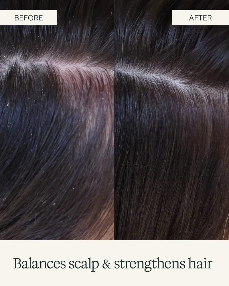 Scalp Exfoliating Shampoo