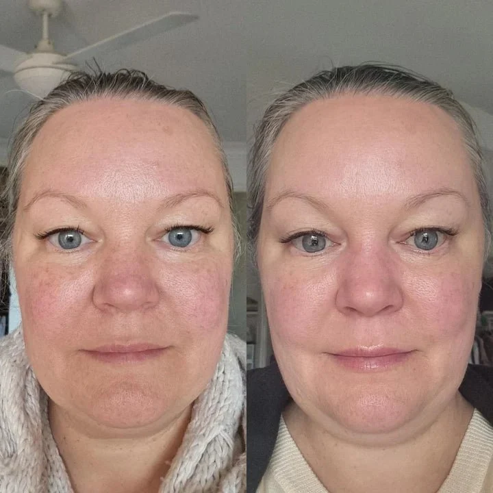 Serum of Clear 30 ml