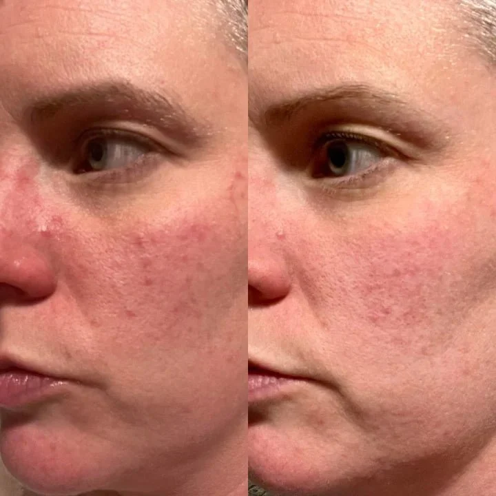 Serum of Clear 30 ml