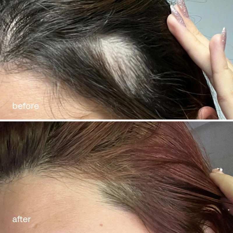 UKLASH Haarwachstumsserum