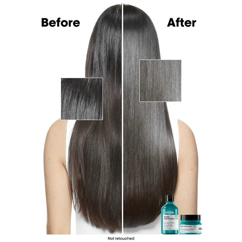 Scalp Advanced Oiliness Shampoo 300ml