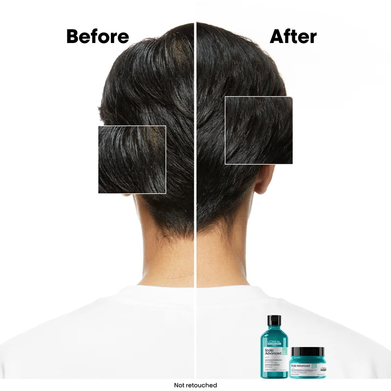 Scalp Advanced Oiliness Shampoo 300ml