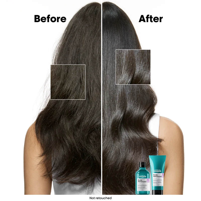 Scalp Advanced Discomfort Shampoo 300ml