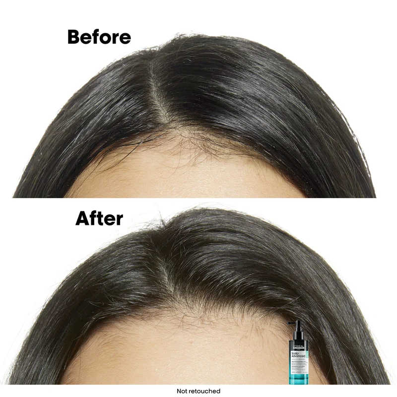 Scalp Advanced Anti-Oily Spray 90mL