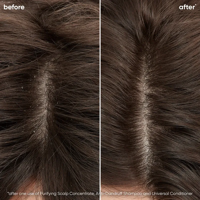 Scalp Sync Purifying Scalp Concentrate 200ml