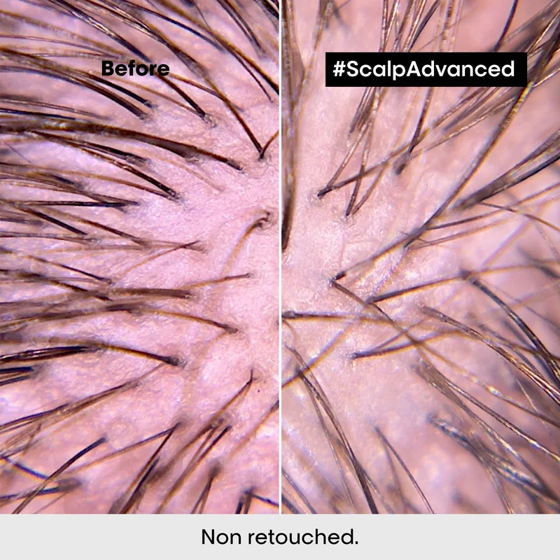 Scalp Advanced Anti Discomfort Treatment 200ml