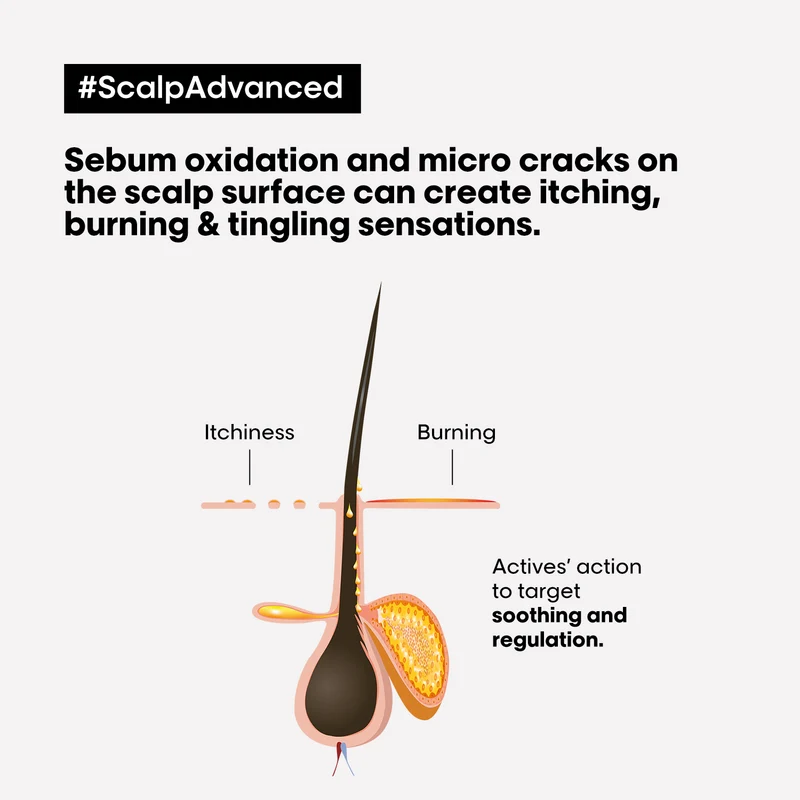 Scalp Advanced Anti Discomfort Treatment 200ml