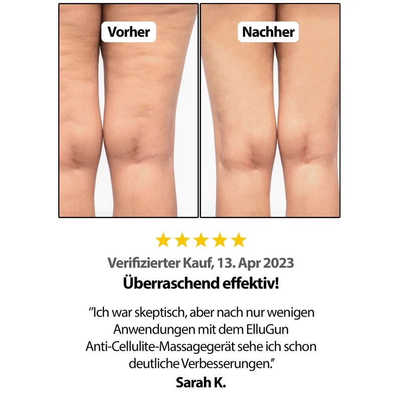 Anti Cellulite - INFRAROT MASSAGEGERÄT 2.0