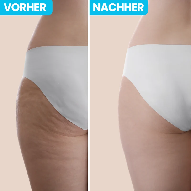 Anti Cellulite - INFRAROT MASSAGEGERÄT 2.0