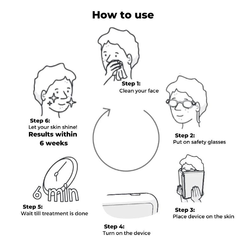 DemarkQ WOW LED Light Full Facial Acne Treatment
