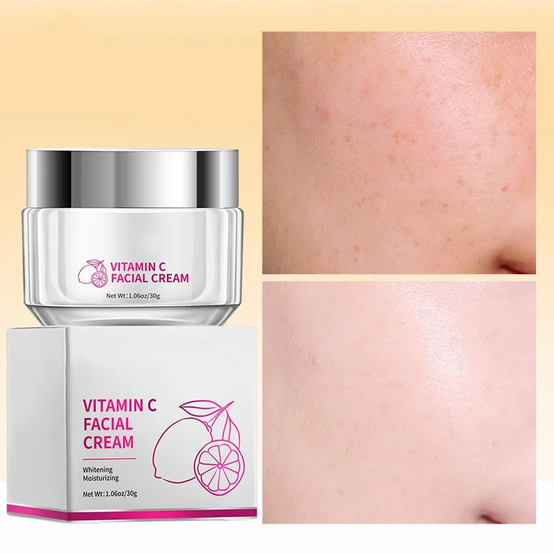 Vitamin C Face Cream - 30g Face Cream for Universal Use