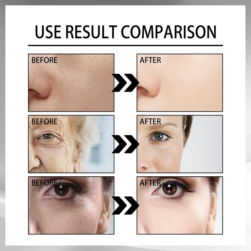 Snail Cream: Fade Wrinkles, Firm Skin Now