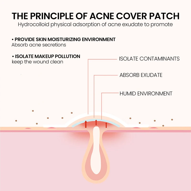 Repair Acne Patch for Clear Skin Without Irritation