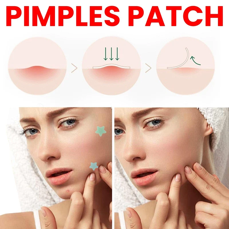 Repair Acne Patch for Clear Skin Without Irritation