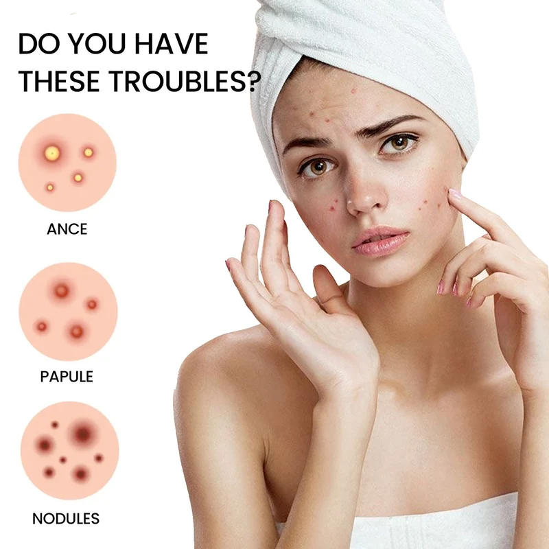 Repair Acne Patch for Clear Skin Without Irritation